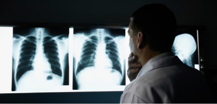 Tedcas cierra una ronda un medió millón para acelerar su internacionalización Tedcas cierra una ronda un medió millón para acelerar su internacionalización